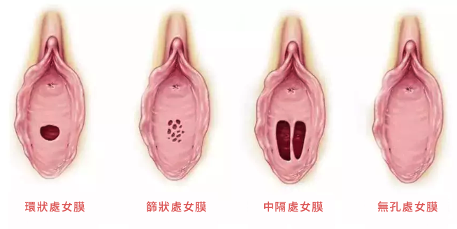 破處會流多少血-破處-第一次沒流血